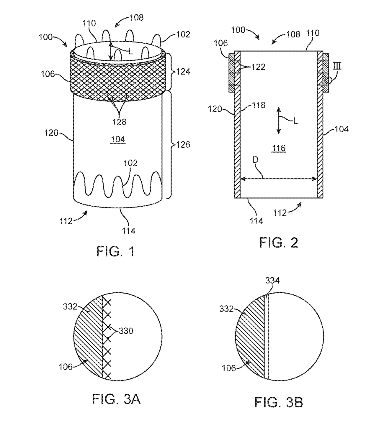 Stent graft with external scaffolding and method