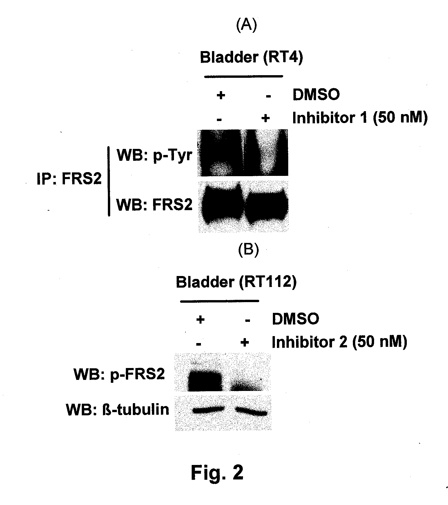 Method of identification of cells that show sensitivity to modulation of signaling mediated by a fibroblast growth factor receptor or a variant thereof