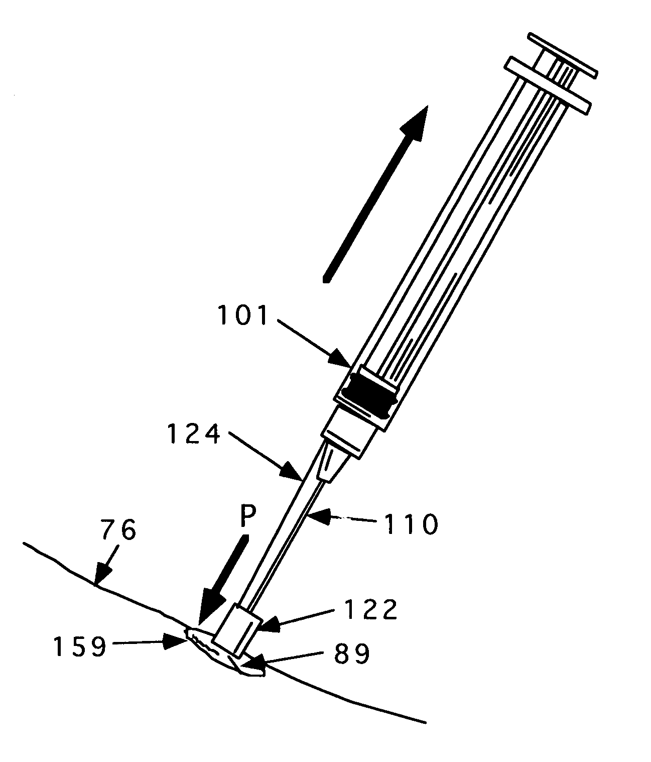 Method and apparatus for indicating or covering a percutaneous puncture site