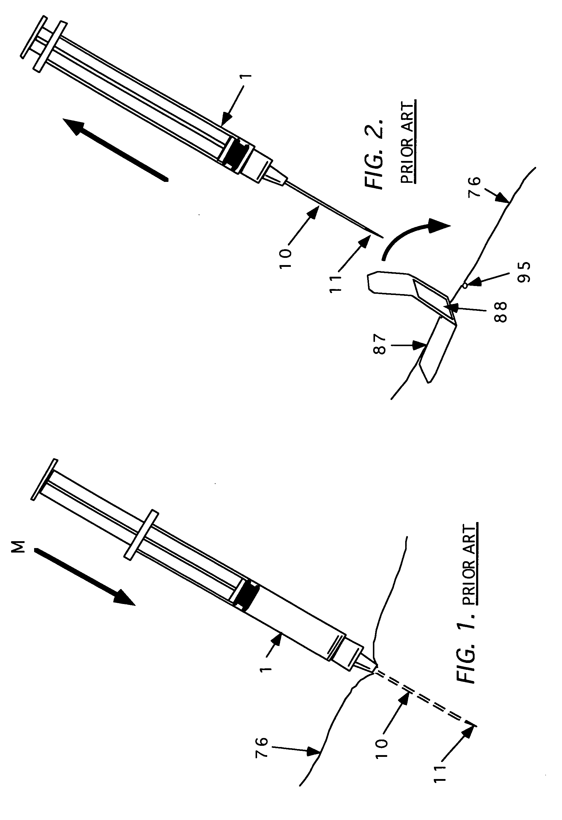 Method and apparatus for indicating or covering a percutaneous puncture site