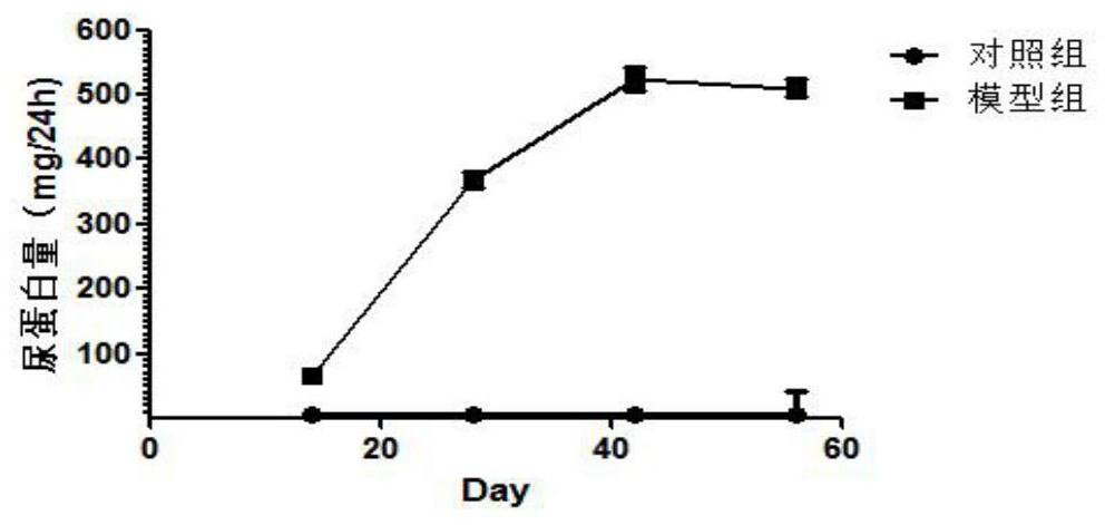 An Interfering Sequence of IL-17 Gene Closely Related to Podocyte Injury in Primary Nephrotic Syndrome