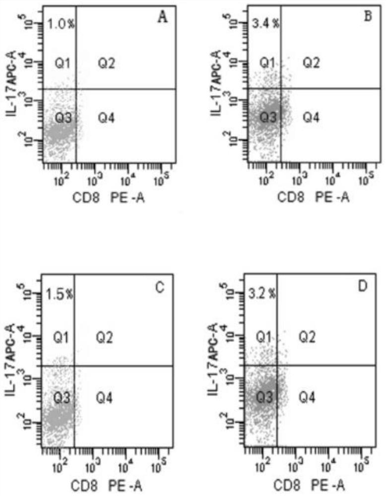 An Interfering Sequence of IL-17 Gene Closely Related to Podocyte Injury in Primary Nephrotic Syndrome