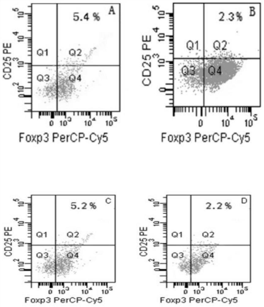 An Interfering Sequence of IL-17 Gene Closely Related to Podocyte Injury in Primary Nephrotic Syndrome