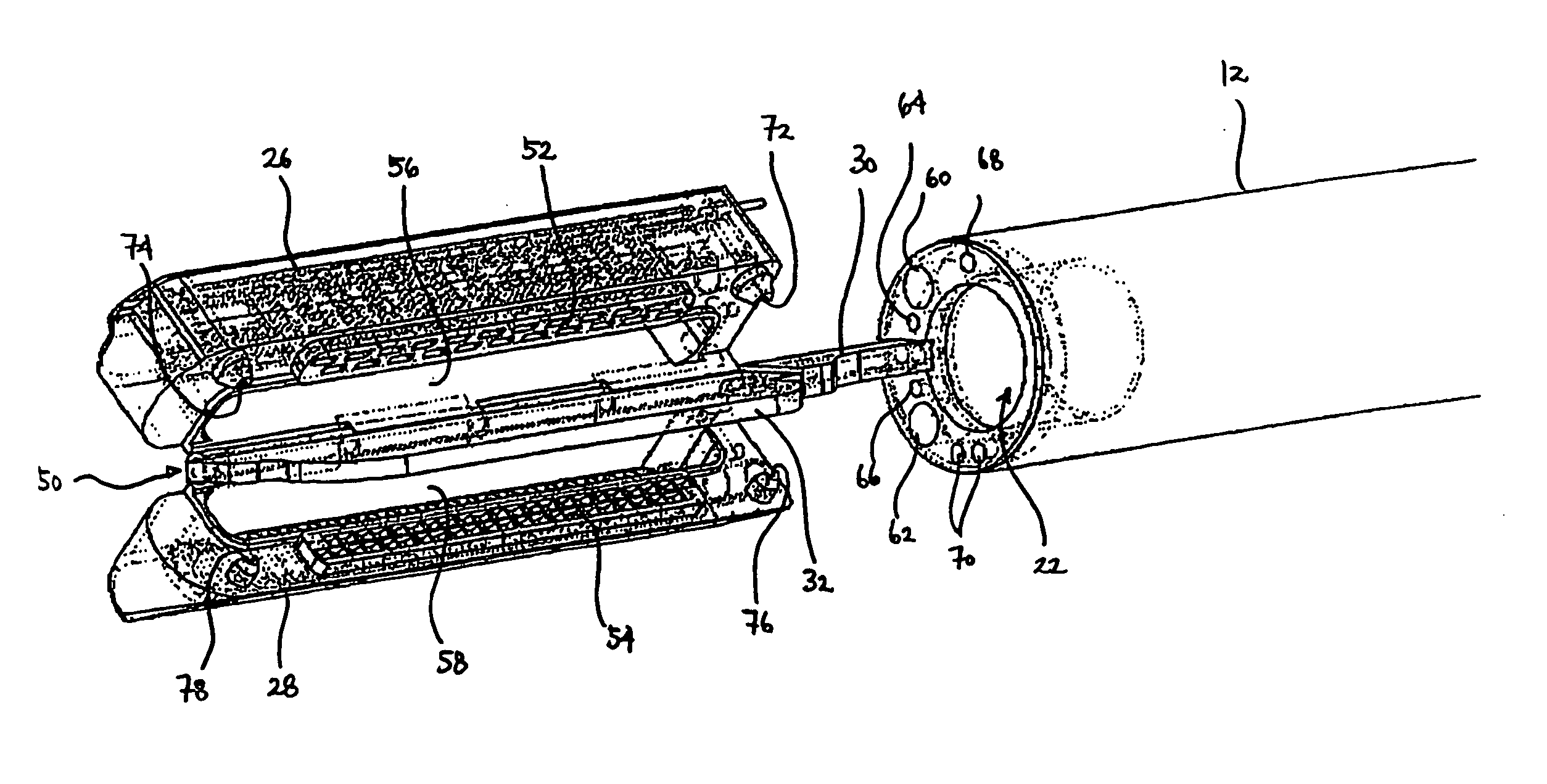 Devices and methods for placement of partitions within a hollow body organ