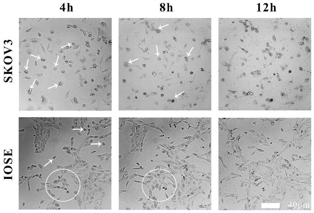 no  <sup>n</sup> -Application of acyl amino acid ester in the preparation of antitumor drugs