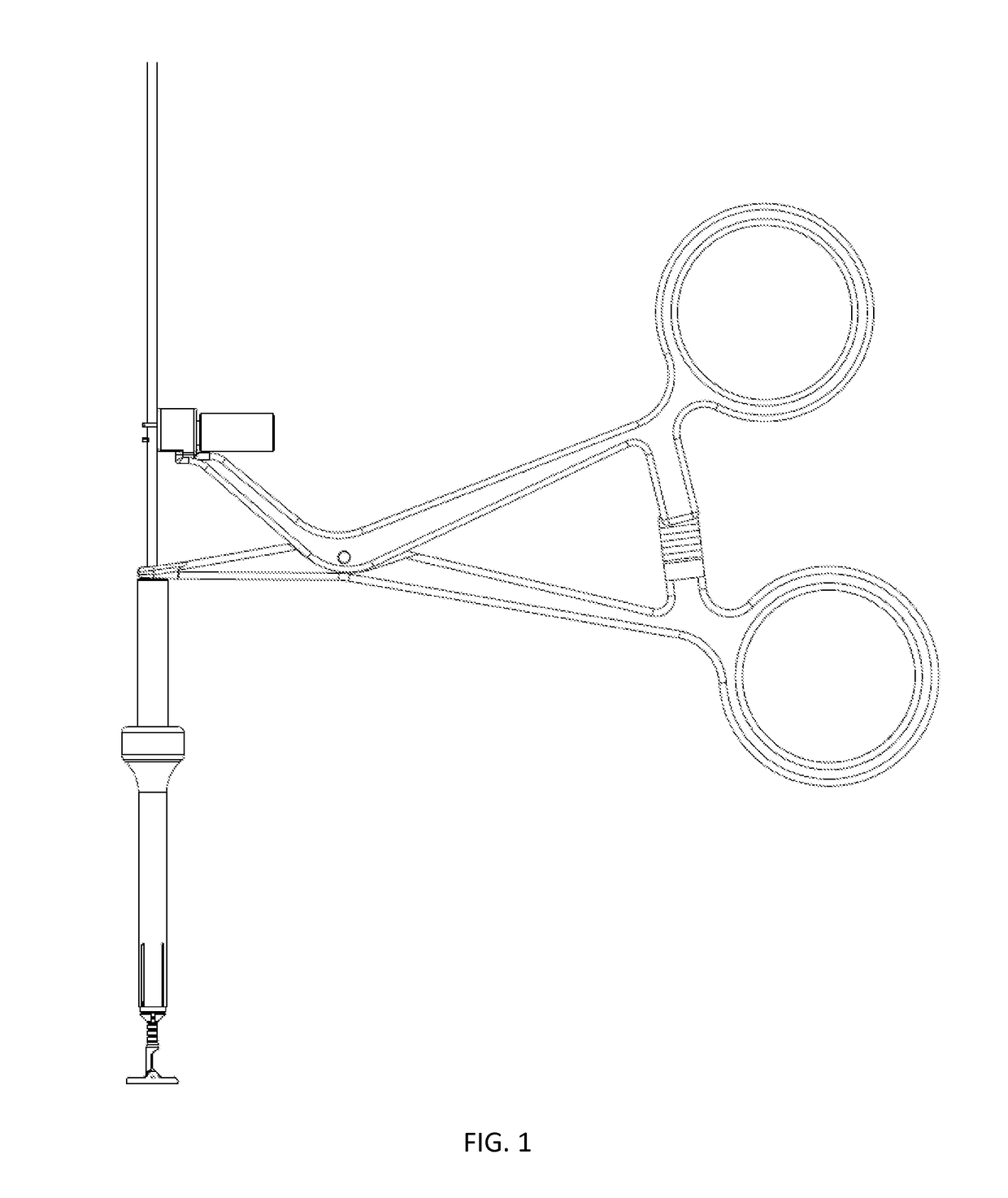 Compression fixation system