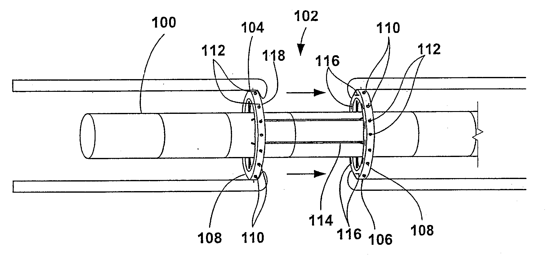 Apparatus and method for endoscopic colectomy