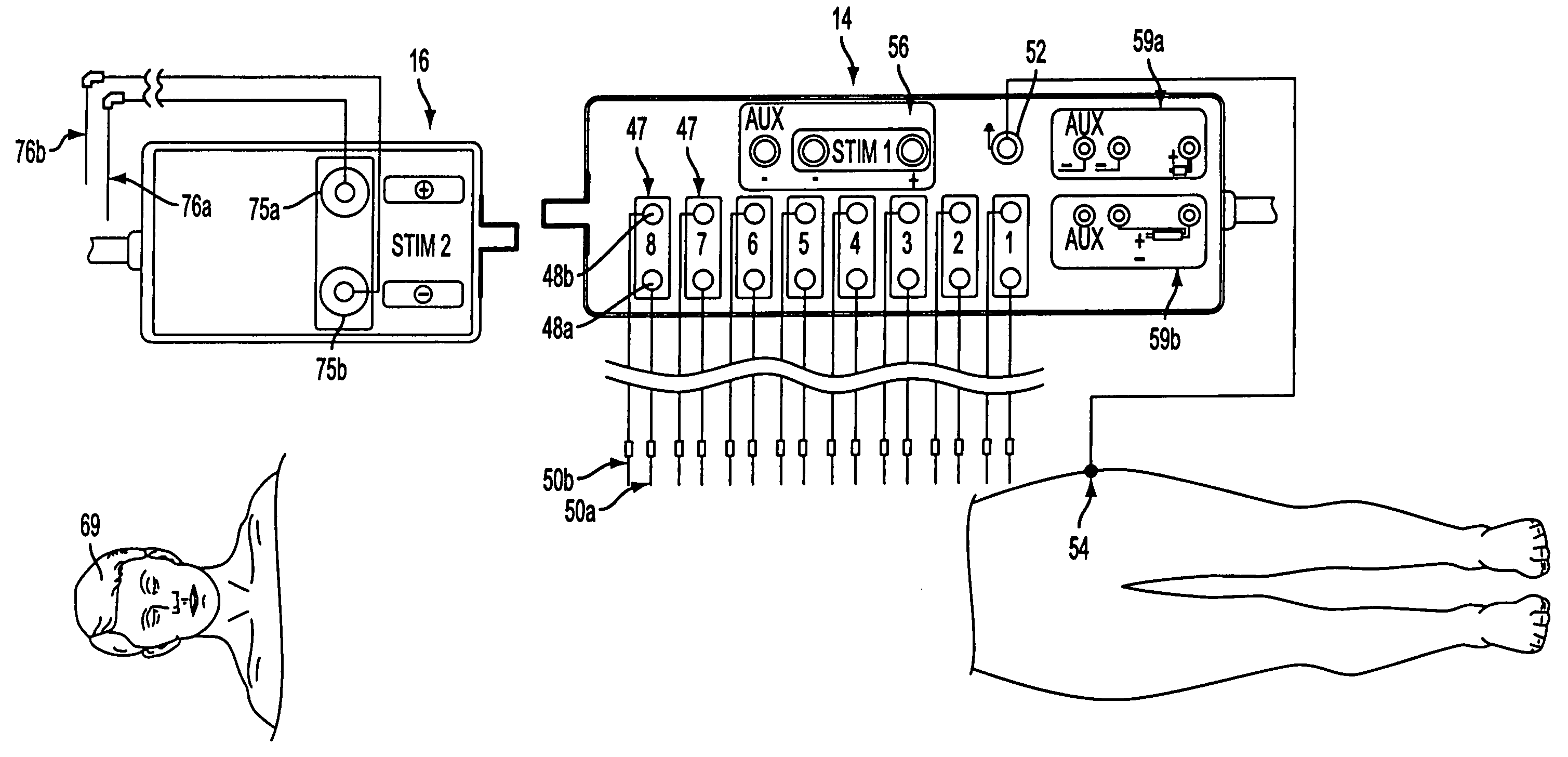 Apparatus for intraoperative neural monitoring