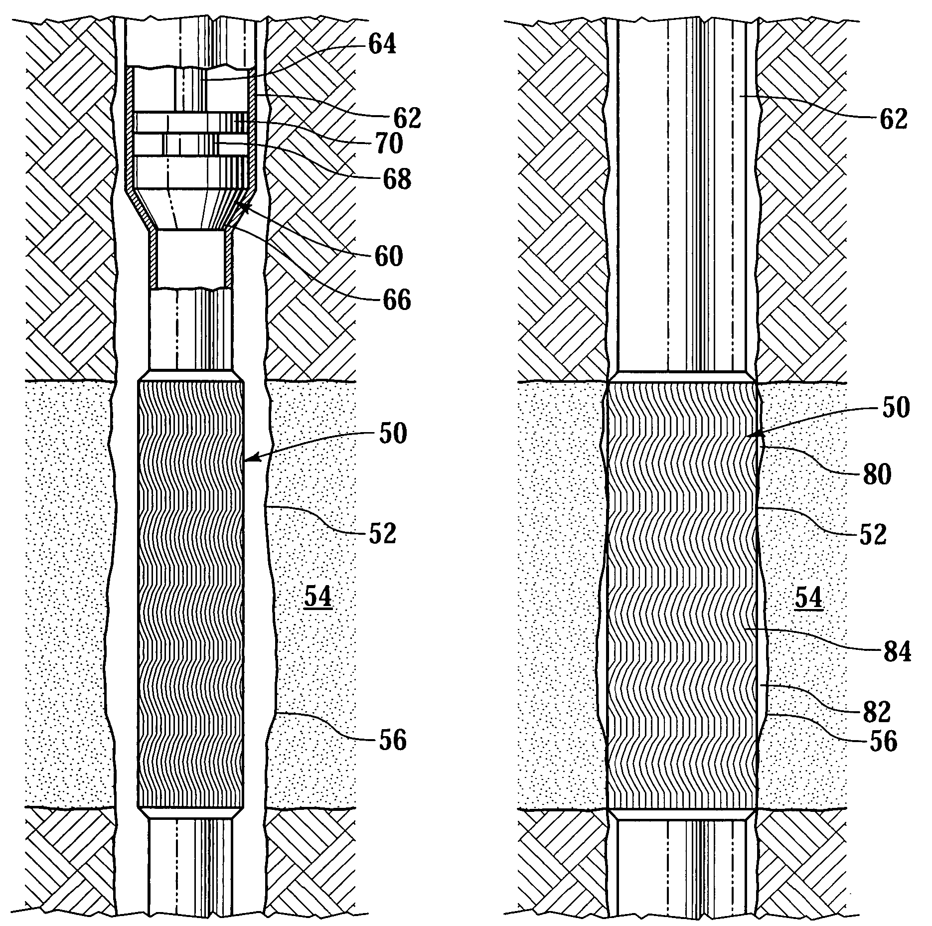 Expandable sand control screen and method for use of same