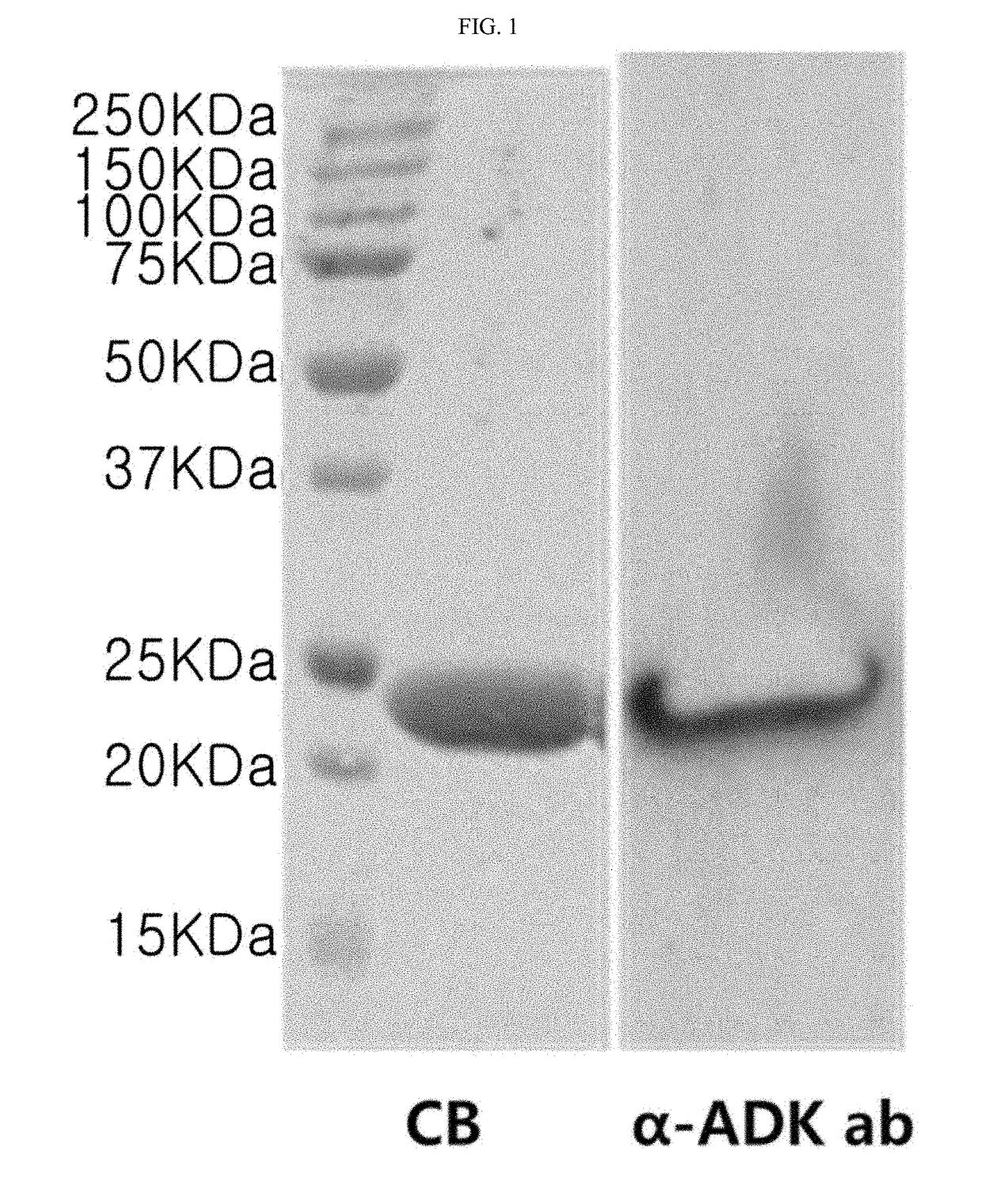 Antibacterial composition containing adk protein as active ingredient, or composition for preventing or treating sepsis