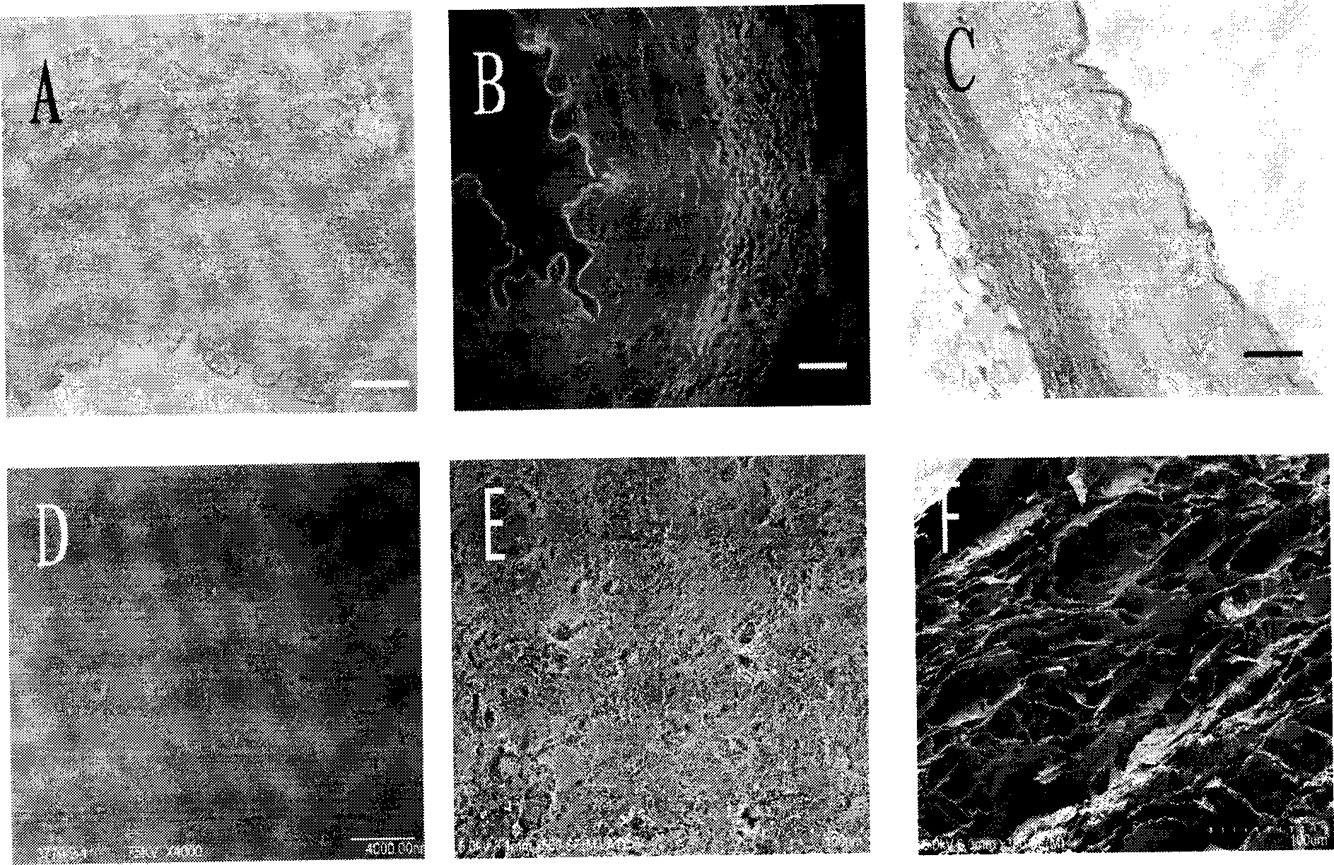 Vascular substrate without cell in vascular tissue and preparation method thereof