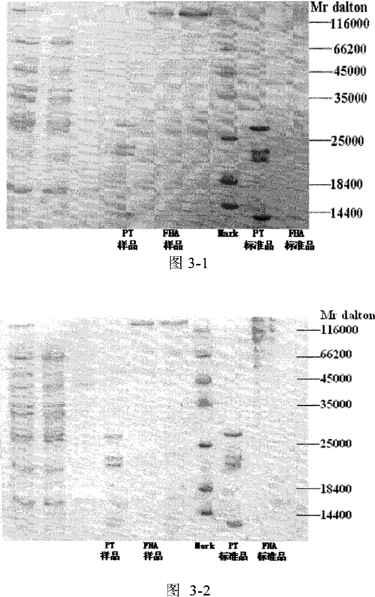 Preparation method of acellular pertussis vaccine