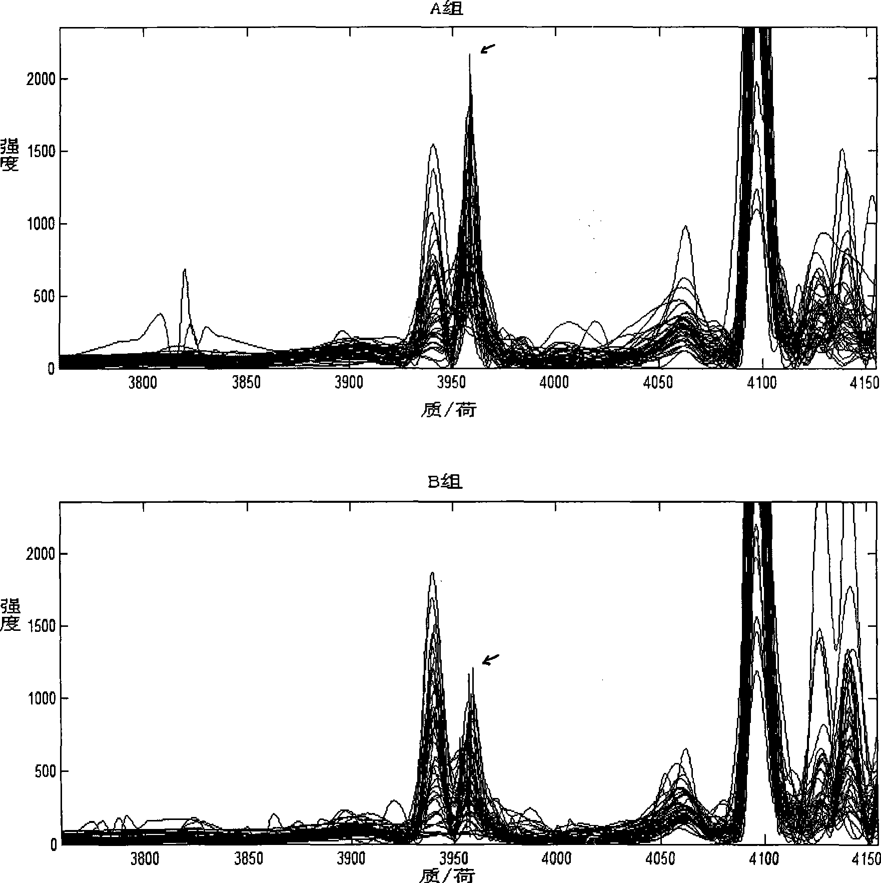 Method for detecting cancer of stomach prognosis and staging blood serum protein