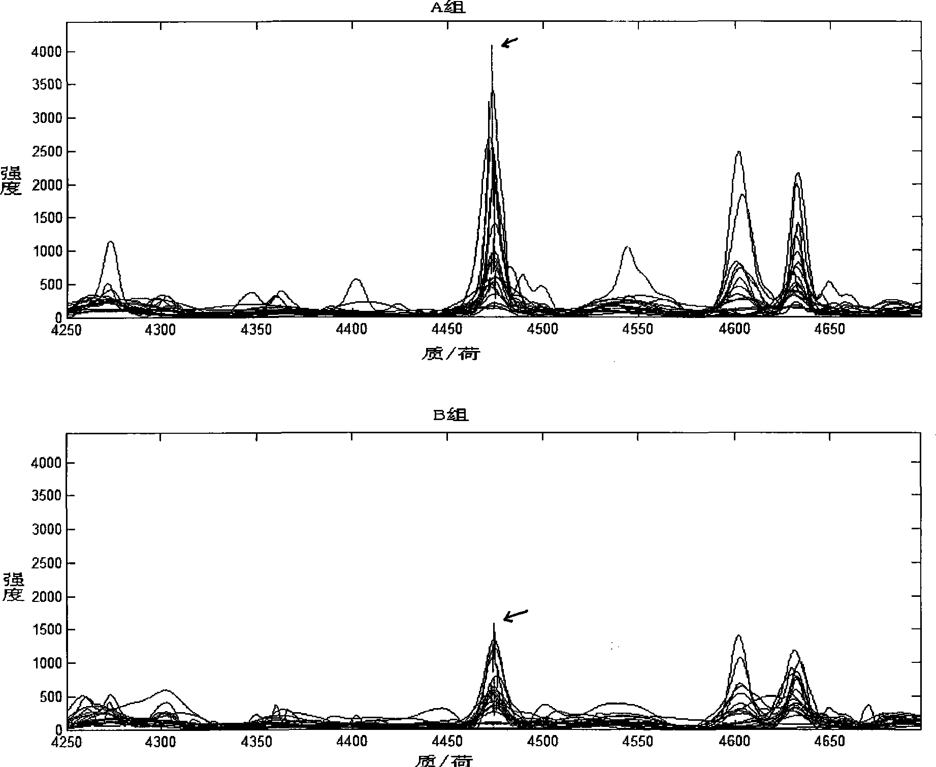 Method for detecting cancer of stomach prognosis and staging blood serum protein