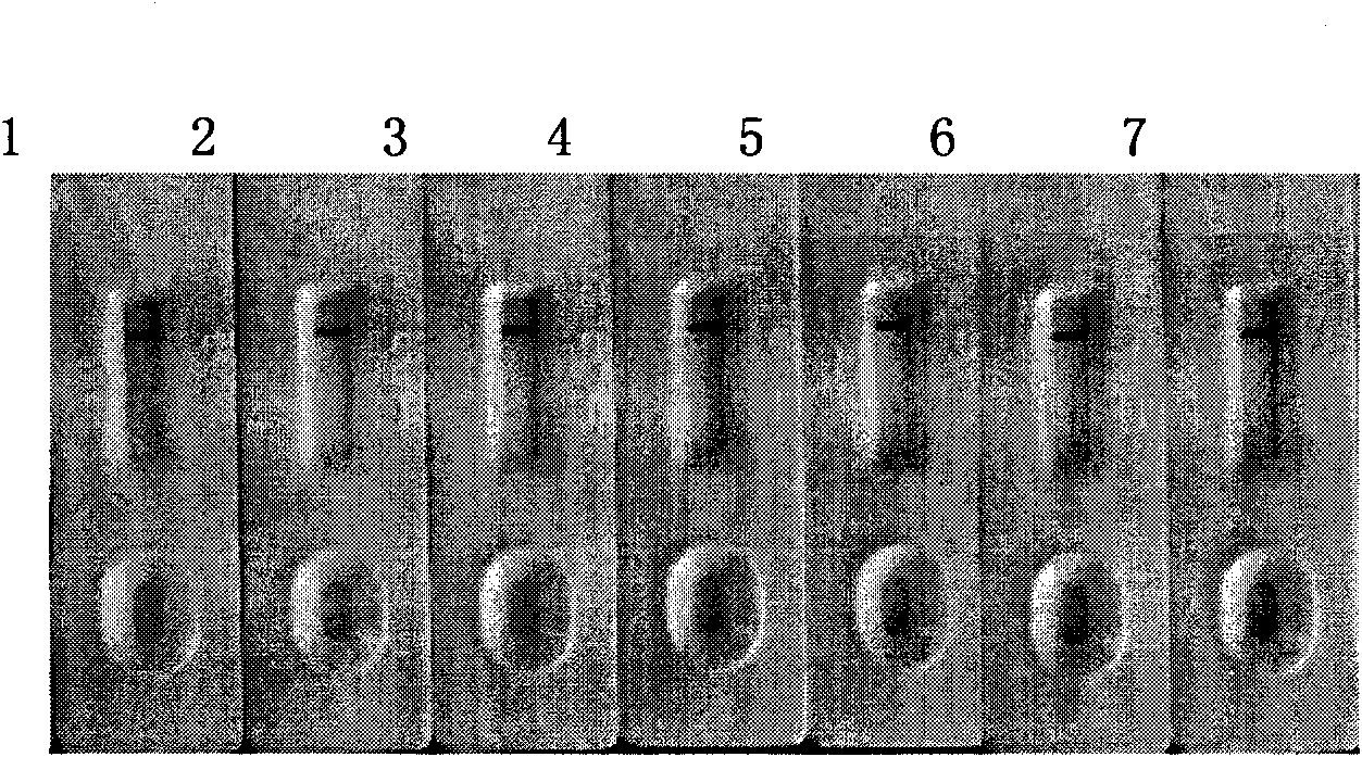 New colloidal gold immunochromatographic method for fast qualitative and quantitative detection of ricin