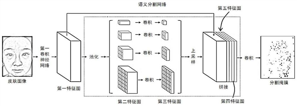 Skin analysis method and device, storage medium and electronic equipment