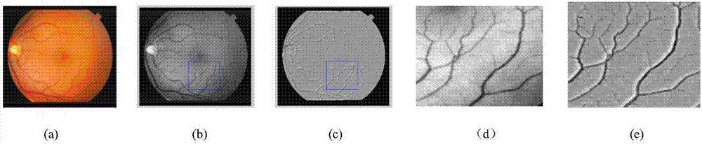 Multi-characteristic fusion monitored retinal blood vessel extraction method