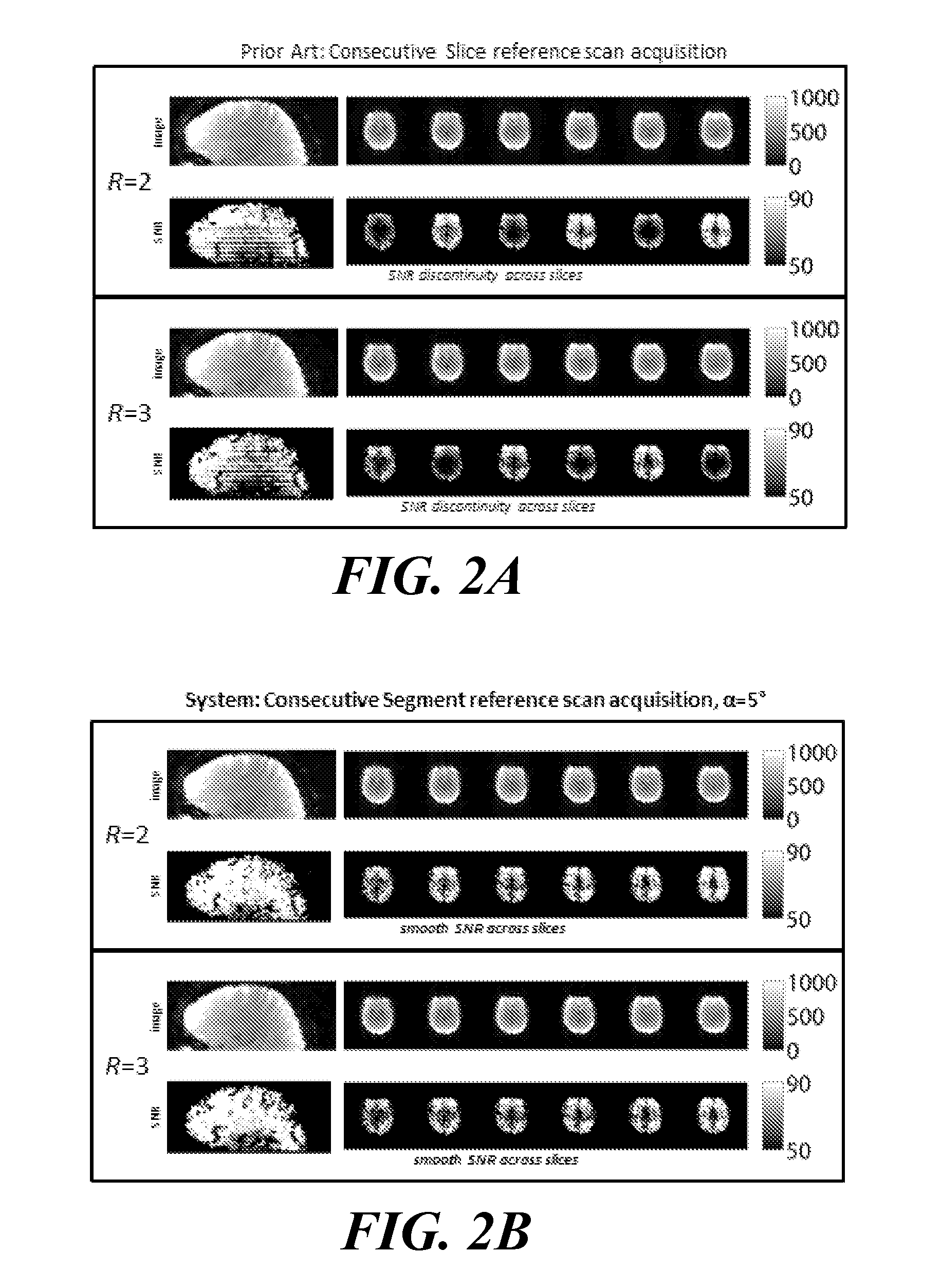 System for Accelerated Segmented MR Image Data Acquisition