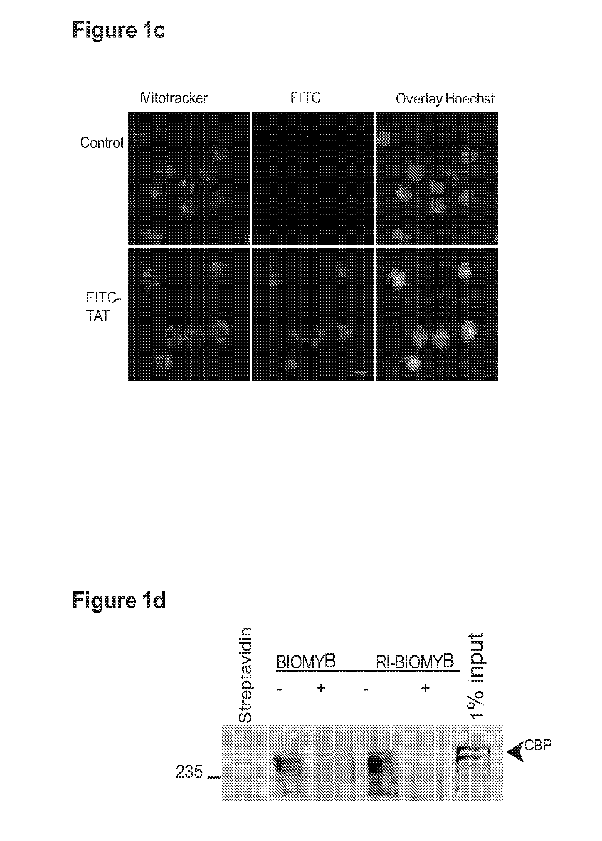 Agents and methods for treating cbp-dependent cancers