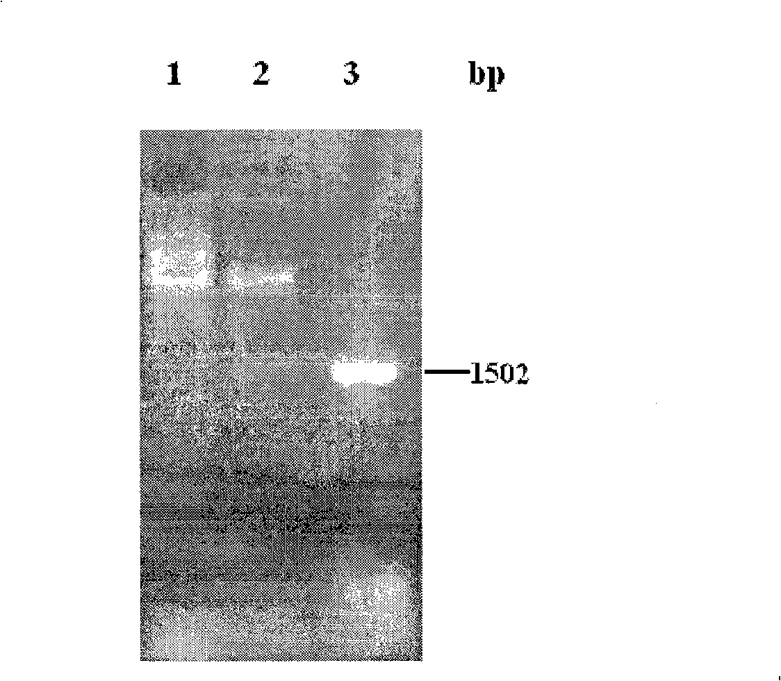 Preparation method of lycopene