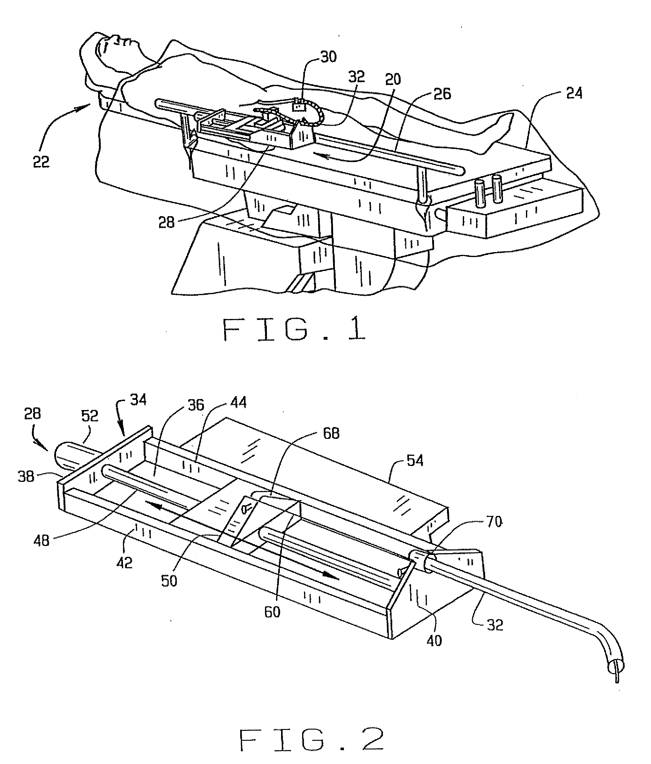 System and Methods for Advancing a Catheter