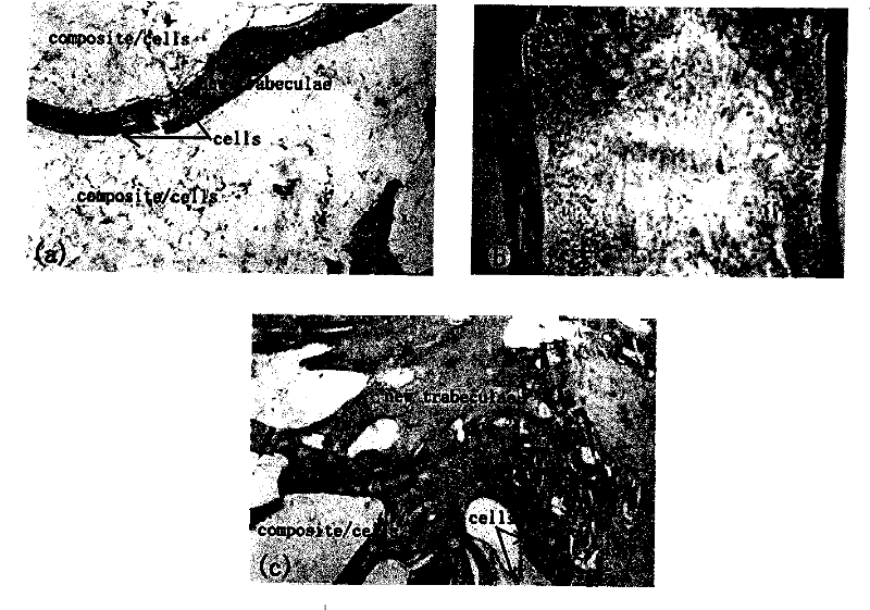 Bone repair material containing nano hydroxylapatite/collagen particle and preparation thereof