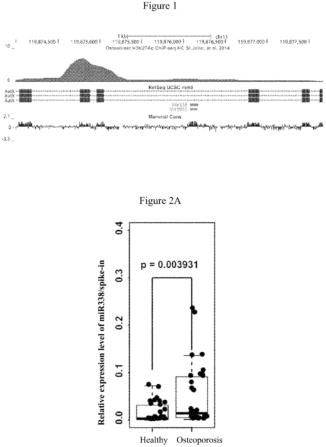 MiRNA marker and kit associated with postmenopausal osteoporosis