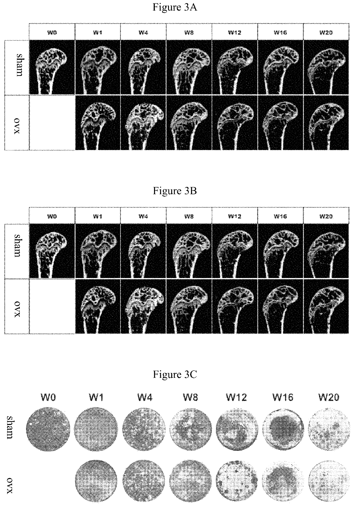 MiRNA marker and kit associated with postmenopausal osteoporosis