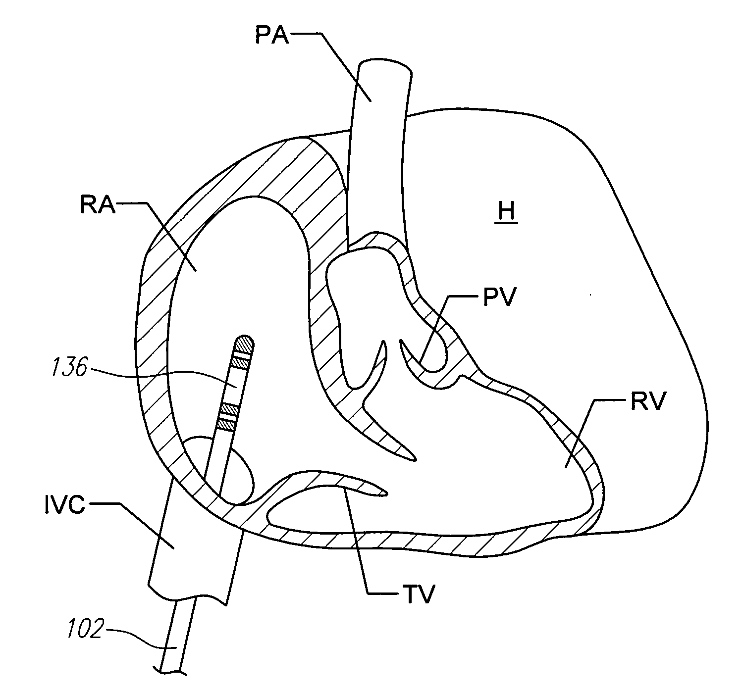 Magnetic navigation systems with dynamic mechanically manipulatable catheters