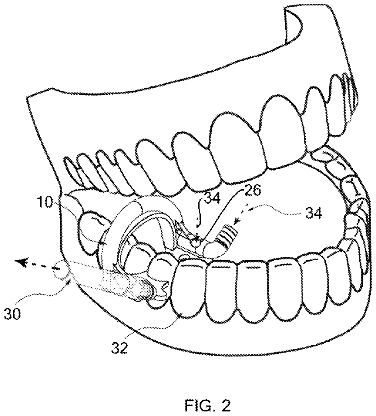 Oral rubber dam clamp