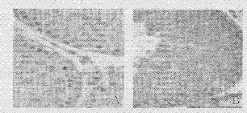 Gene vaccine of sperm-specific cationic channel protein CatSper1 and preparation method thereof