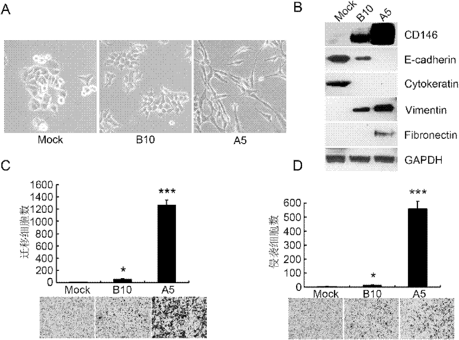 CD146 and antibody diagnosis thereof, and application in treating triple negative breast cancer