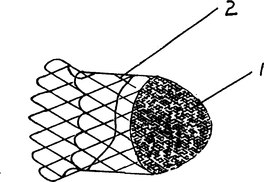 Implantation type thrombus filter