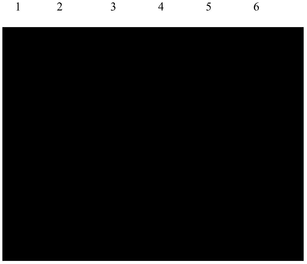 Mycobacterium tuberculosis specific recombinant protein OTC as well as preparation method and application thereof