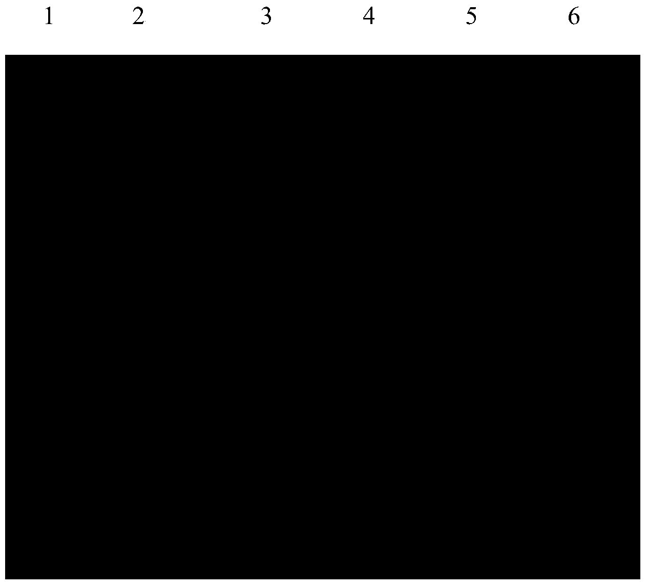 Mycobacterium tuberculosis specific recombinant protein OTC as well as preparation method and application thereof