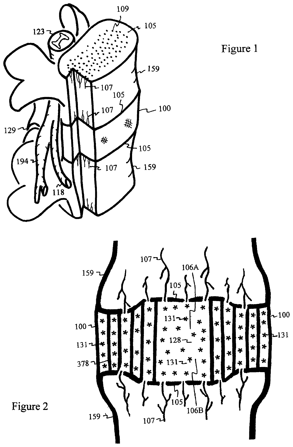 Method for relieving pain and regenerating intervertebral disc