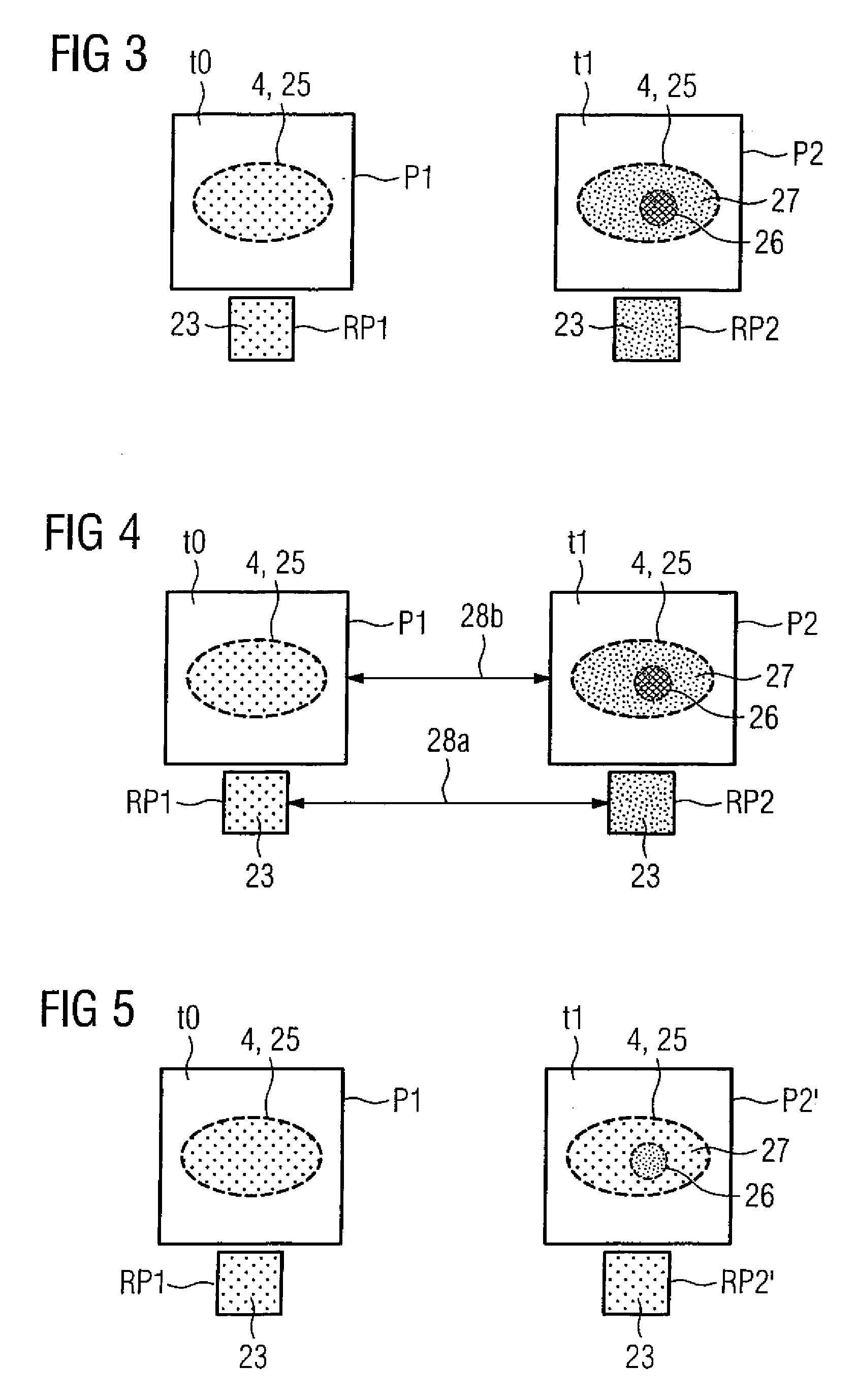 Bo field drift correction in a temperature map generated by magnetic resonance tomography