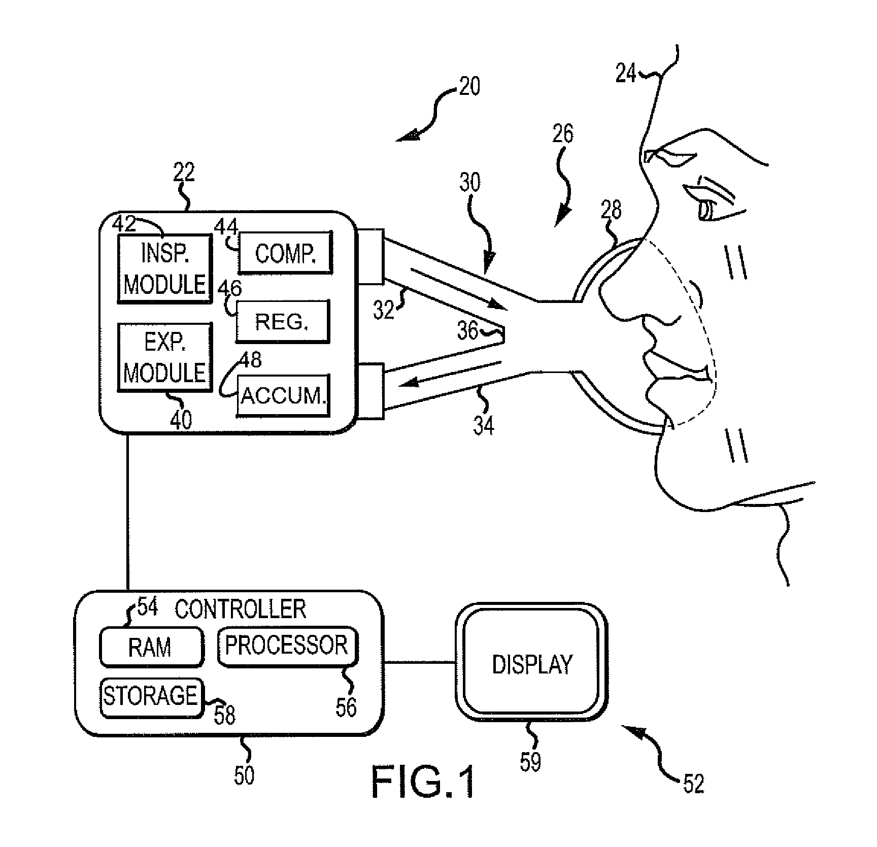 Ventilator Respiratory Gas Accumulator With Sampling Chamber