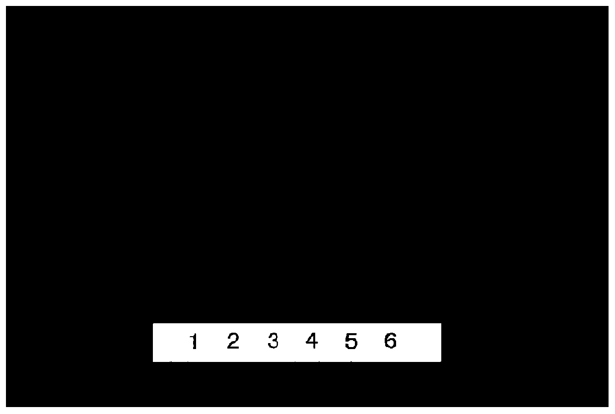 A detection method of traditional Chinese medicine composition for treating bruises