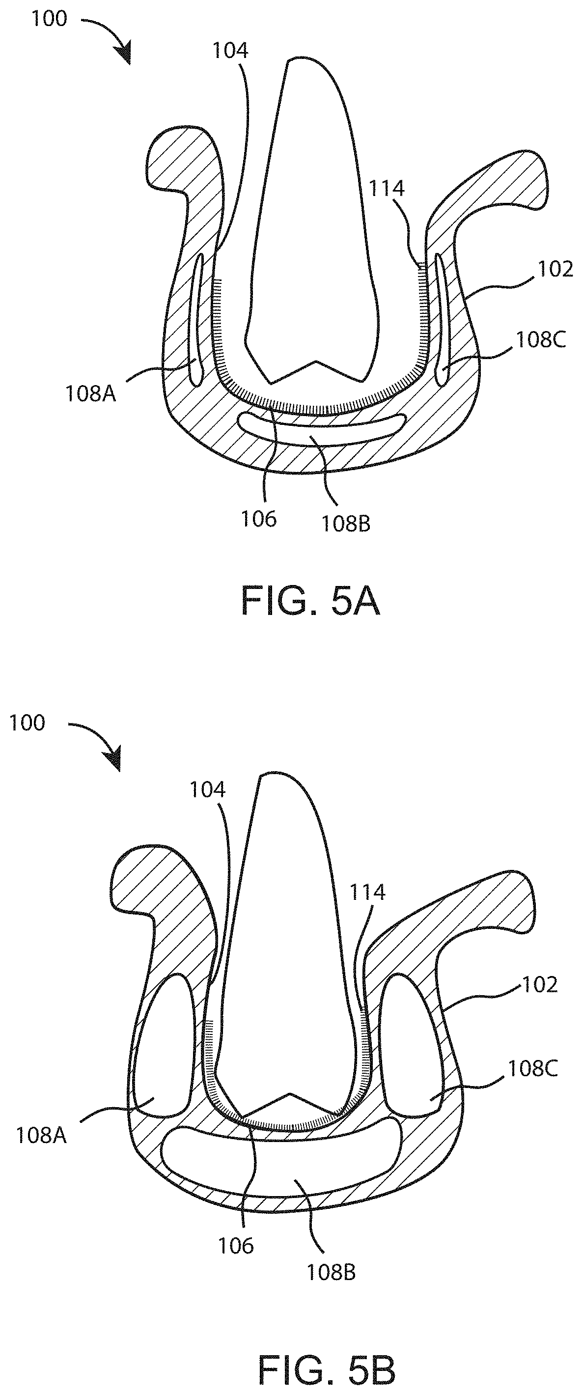 Portable oral care appliance and a method of utilizing the same