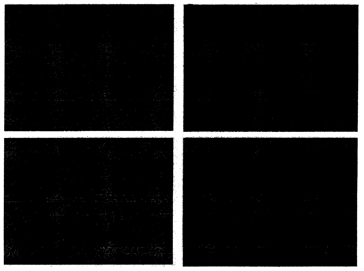 Cell culture composition and use for primary culture of tumor cells