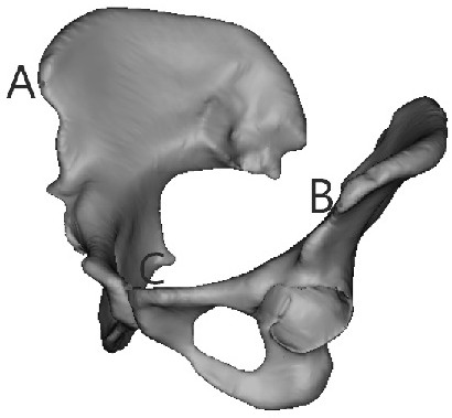 Pelvic bone correction method, operation system, storage medium and electronic equipment