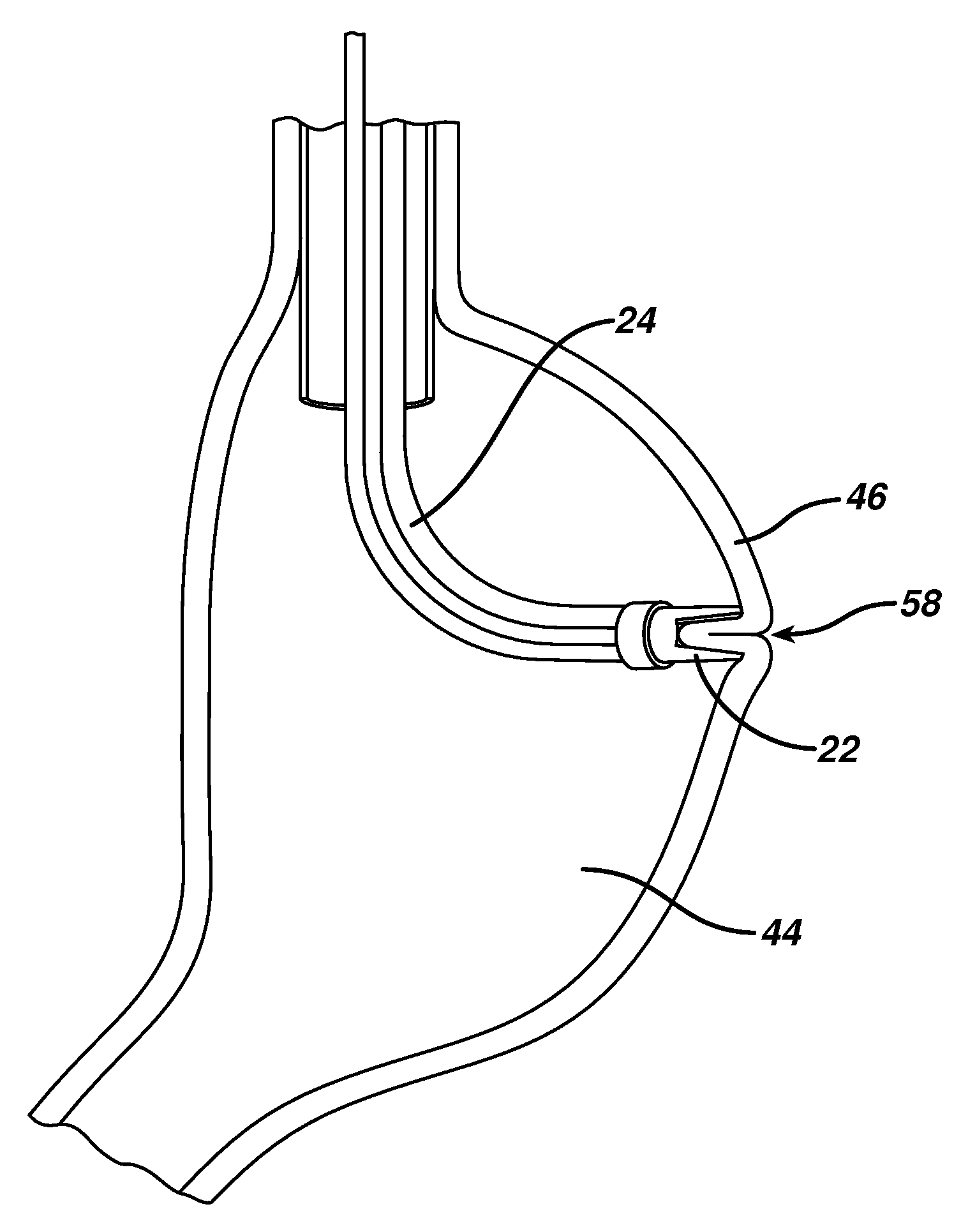 Method for plicating and fastening gastric tissue