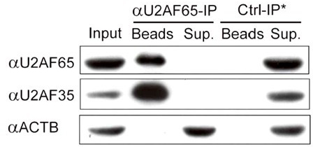 Method for identifying target RNA (Ribonucleic Acid) of RNA binding protein through improved CLIP method