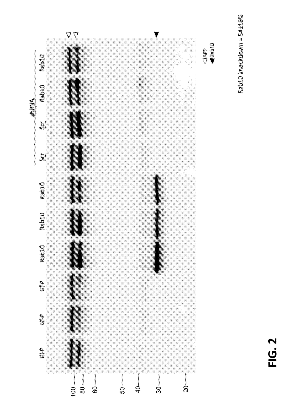 Allelic polymorphisms associated with reduced risk for alzheimer's disease