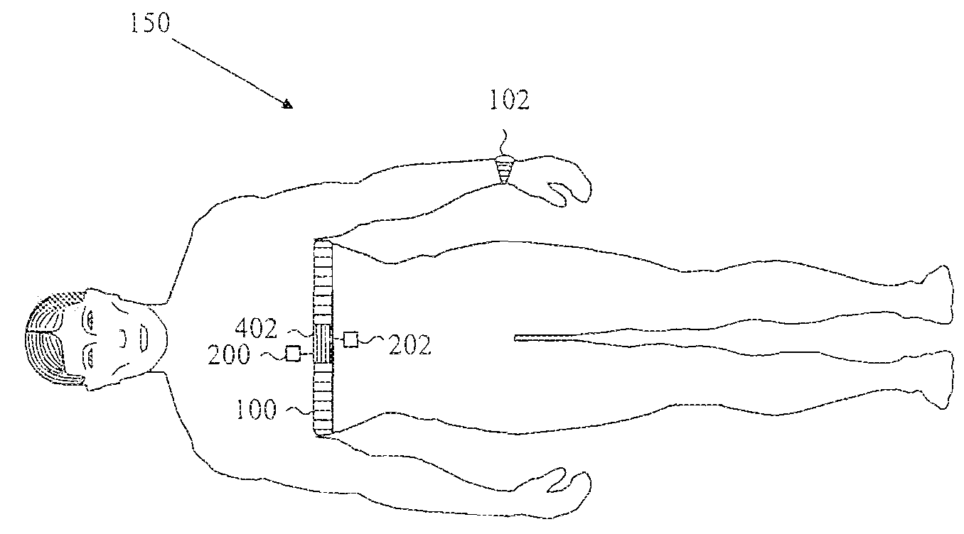 Electrode Structure