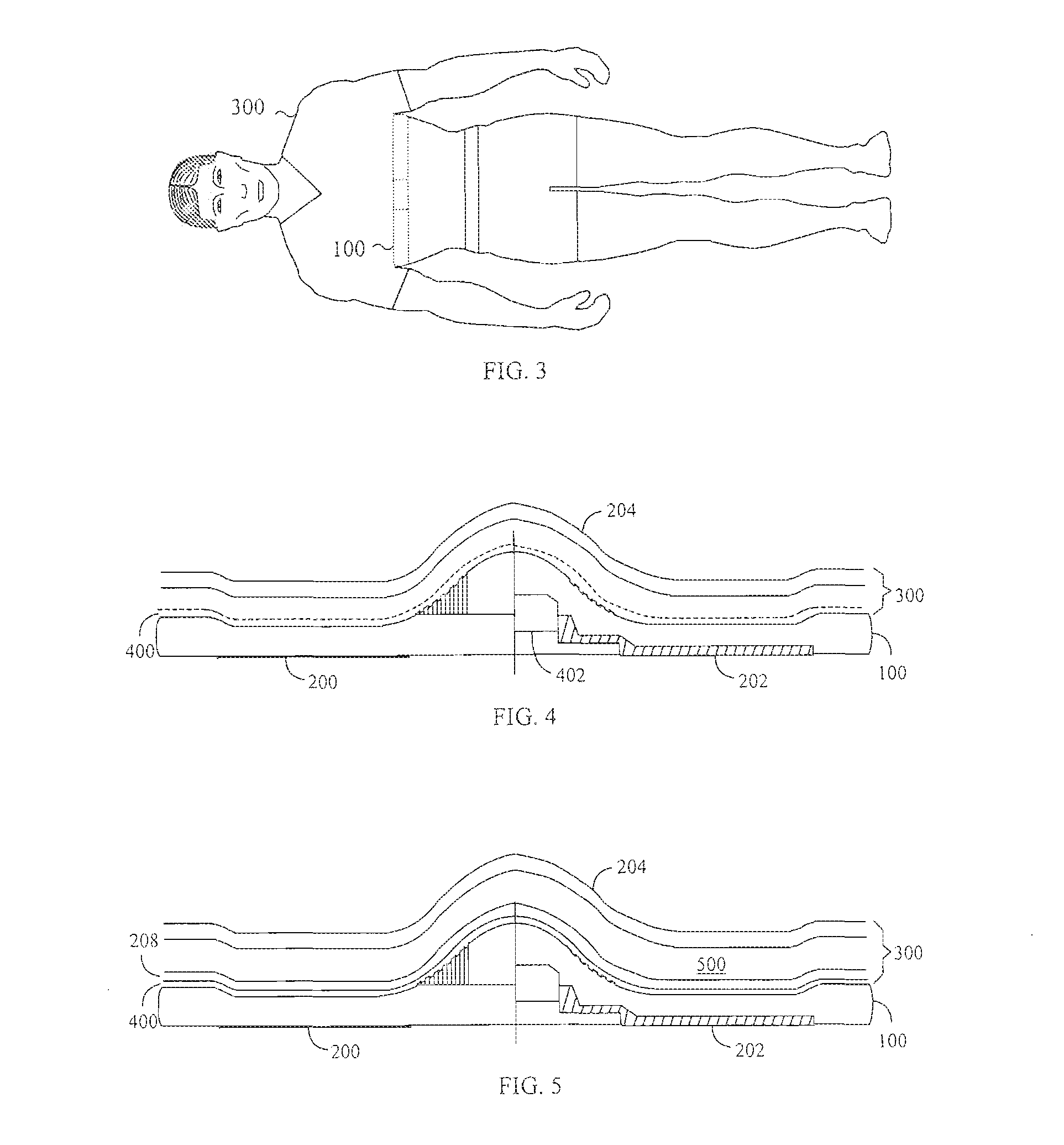 Electrode Structure