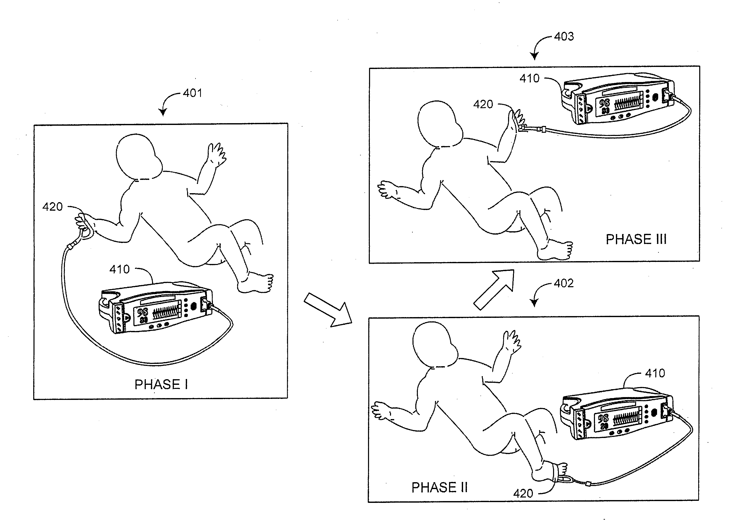 Congenital heart disease monitor