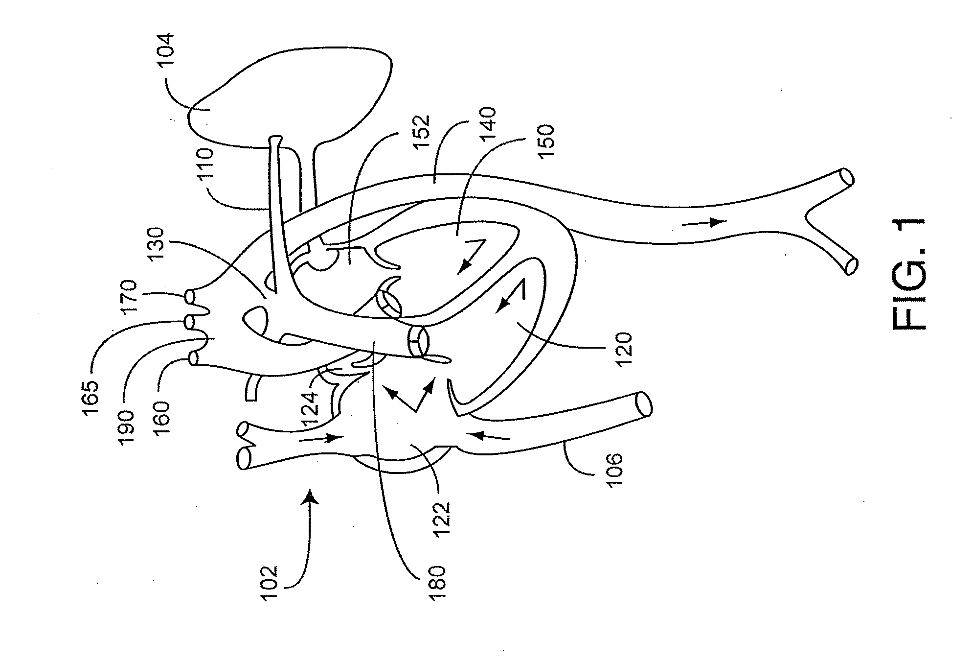 Congenital heart disease monitor