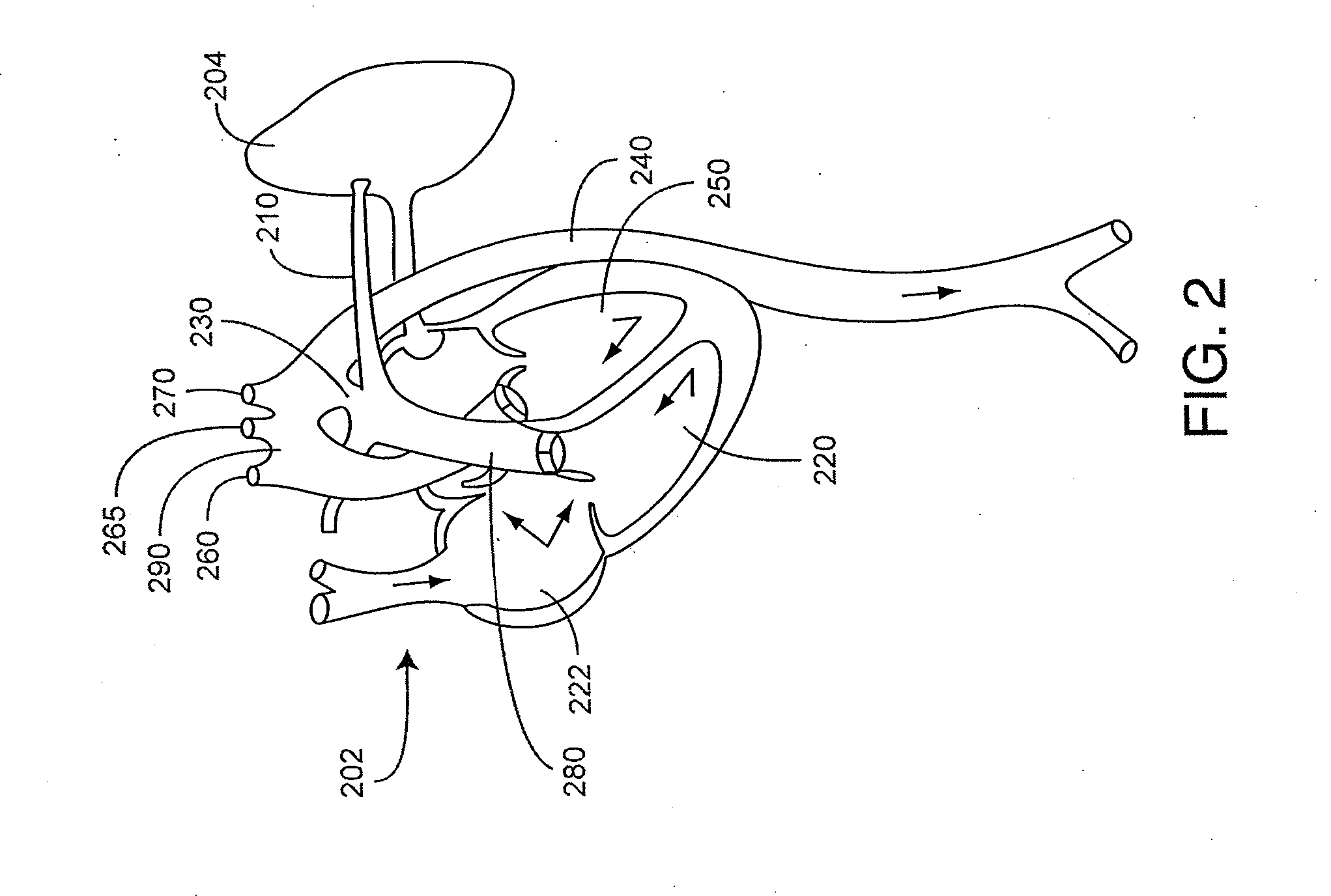 Congenital heart disease monitor